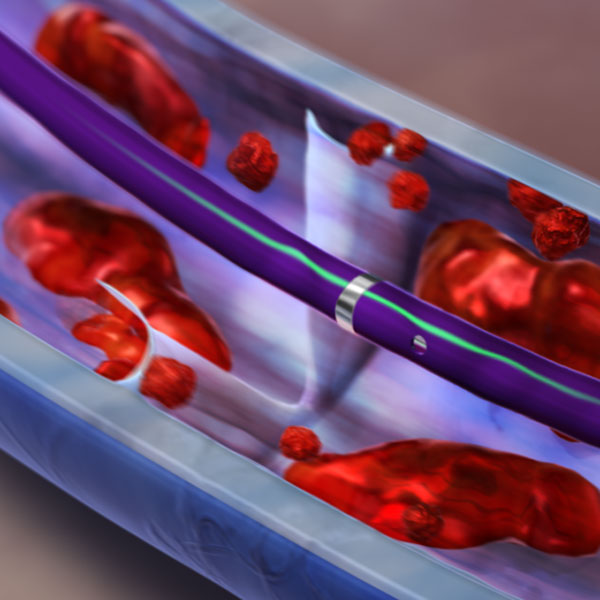 Bayer - DVT Animation