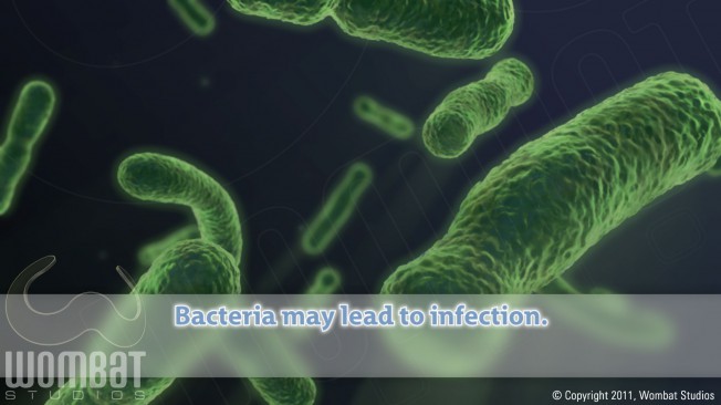 Bacteria Before Treatment