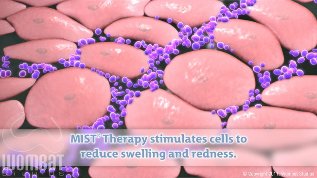 Inflammation After Treatment