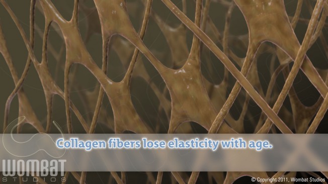 Collagen Fibers Before Treatment