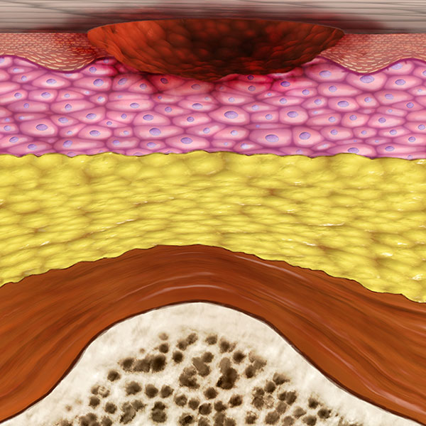 Celleration - Wound Layers