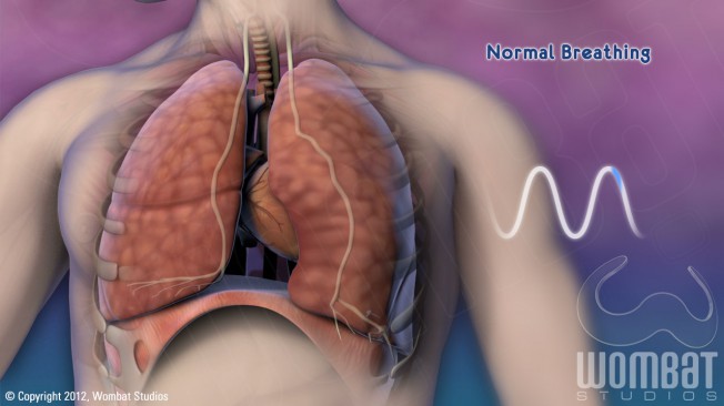 Patient Video - Normal Breathing