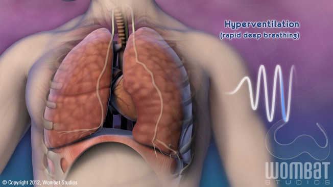 Patient Video - Hyperventilating