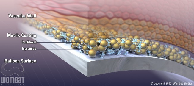 Bayer Paccocath - Cross Section 1