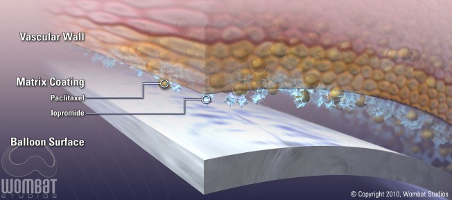 Bayer Paccocath - Cross Section 2