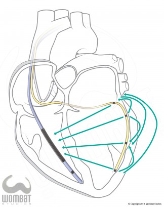 Simple Heart Illustration