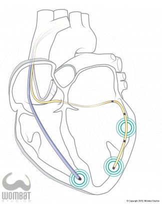 Simple Heart Illustration