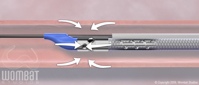 ThromCat Mechanism of Action